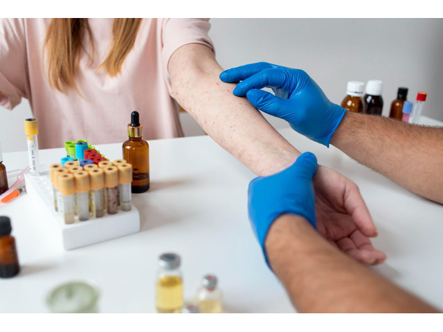 Fungal Infection Treatment in hyderabad