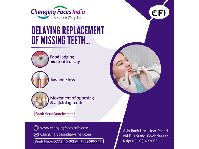 Worried About Missing Teeth? Delay Can Be Risky!