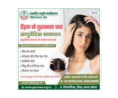 Get Rid of Dandruff Naturally with Ayurvedic Treatment