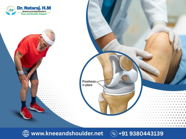 Revision Knee Replacement Treatment in Bangalore: Dr.Nataraj H M