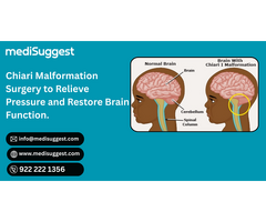 Expert Chiari Malformation Surgery Near Bhayander