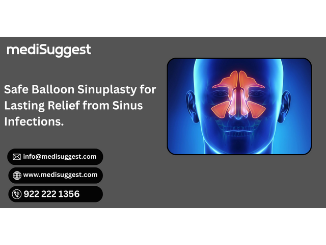 Balloon Sinuplasty Surgery