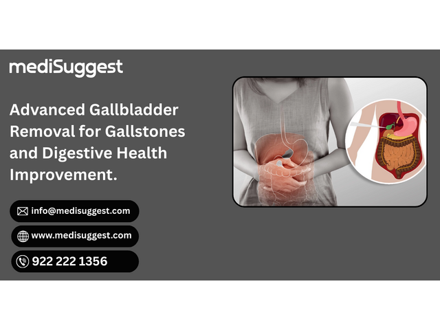 Understanding Cholecystectomy