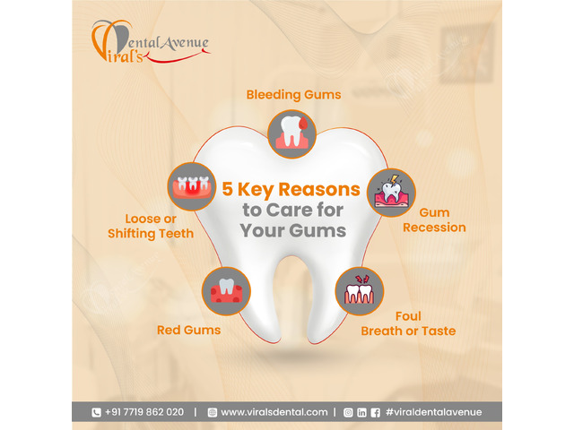 Best Gum Treatment Doctor Mulund