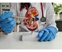 Kidney Stone Specialist – Diagnosis and Treatment Guide