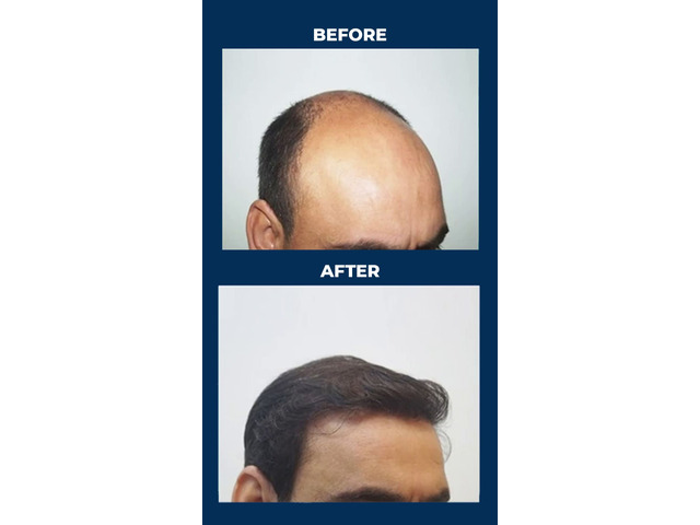 Best Cosmetic & Plastic Surgery Clinic in Hyderabad – Personiks