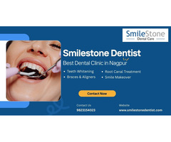 Smilestone Dental Clinic - Best Dentist in Nagpur