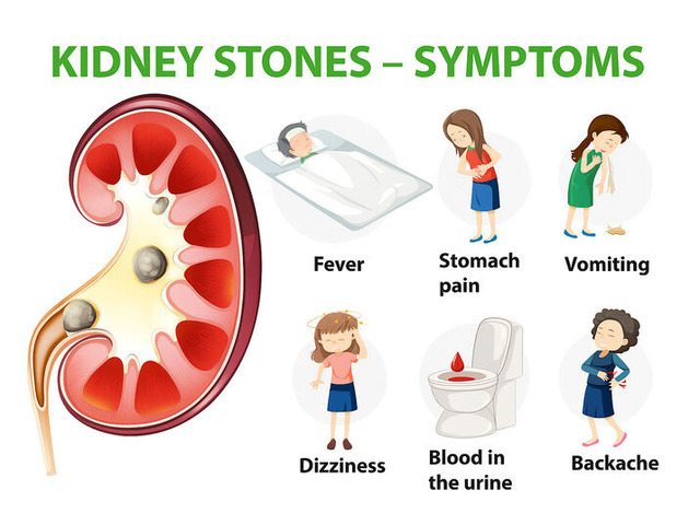 How a Kidney Stone Specialist Diagnoses and Treats Your Pain