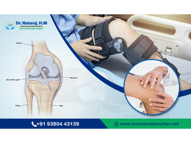 Best Knee Specialist in Bangalore - Dr.Nataraj H M
