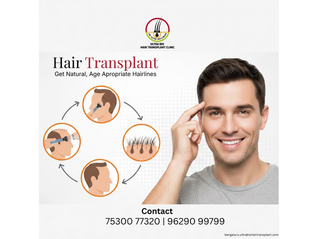 Affordable hair transplant in Bengaluru