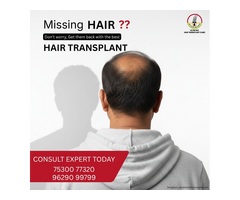 Affordable hair transplant in Bengaluru