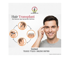 Affordable hair transplant in Bengaluru