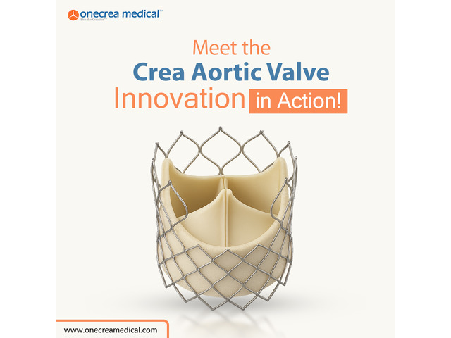 Crea Aortic Valve