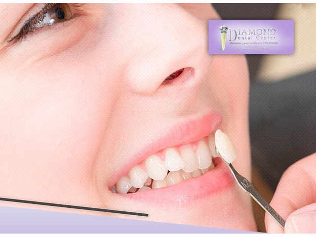 Diamond Dental Center