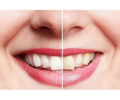 Diamond Dental Center